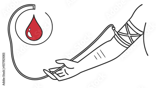 Blood Donation or Collection Process Illustration: Arm with Needle, Tube, and Blood Drop. Medical Procedure Line Art.