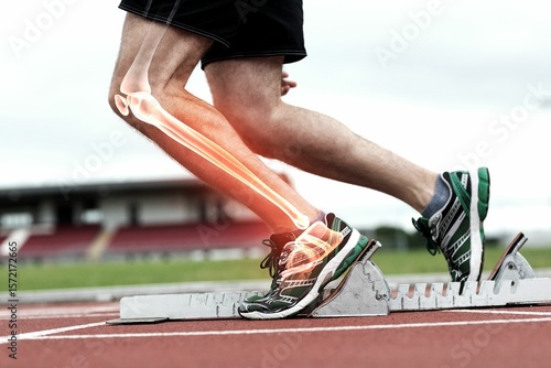 Runner experiencing leg pain