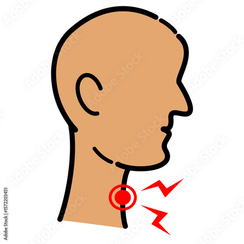 Sore throat. Pain from swallowing or talking, difficulty swallowing, irritation. Pharyngitis. Healthcare. Influenza concept. Isolated vector illustration