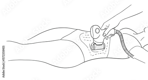 Woman receiving body contouring treatment with device on abdomen  