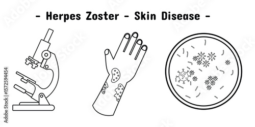 Exposure design of herpes zoster skin disease on the hand and illustration of microscope and virus. In outline style.