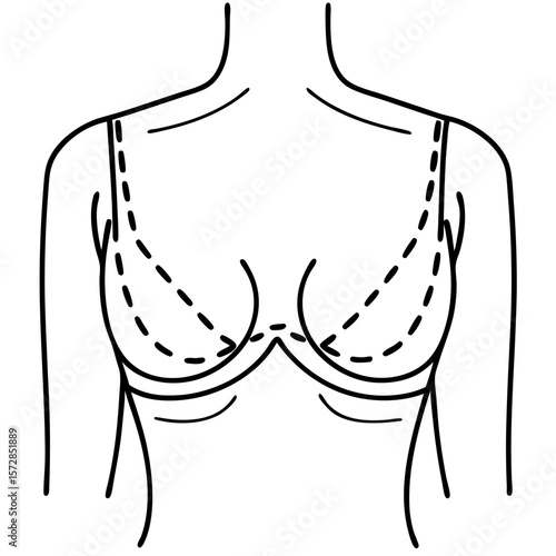 Breast incision lines depicted in a simple line drawing showcasing surgical markings on breasts. Surgical breast incision lines are clearly outlined,