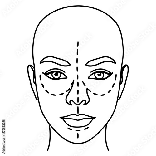 Face with surgical markings indicating cosmetic procedure areas. Face with surgical markings for aesthetic surgery shows areas for potential interventions.