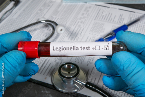 Doctor holding blood sample for legionella test: positive result