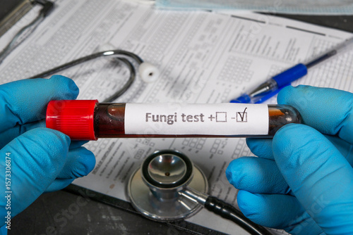 Doctor holding test tube with negative fungi test result