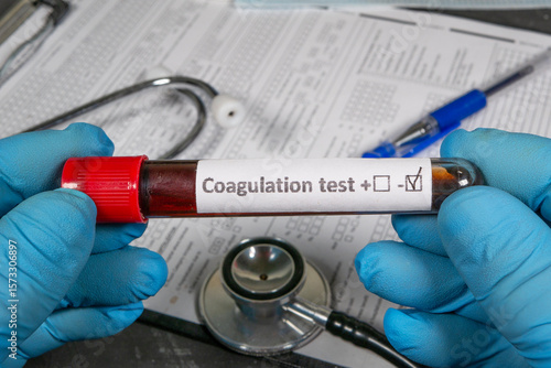 Doctor holding blood sample for coagulation test with positive result
