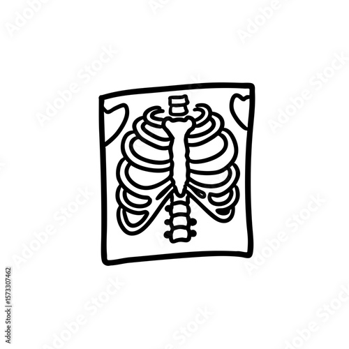X-ray image of ribcage in black and white sketch style  