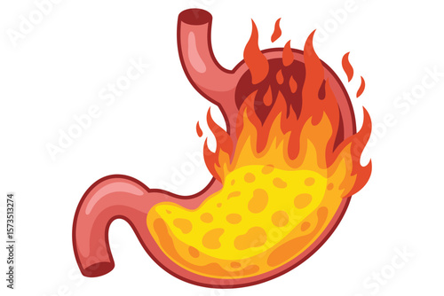 Stomach Burning Pain Illustration