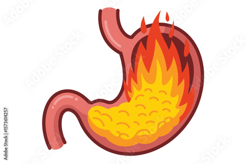 Cartoon stomach on fire representing heartburn or indigestion pain