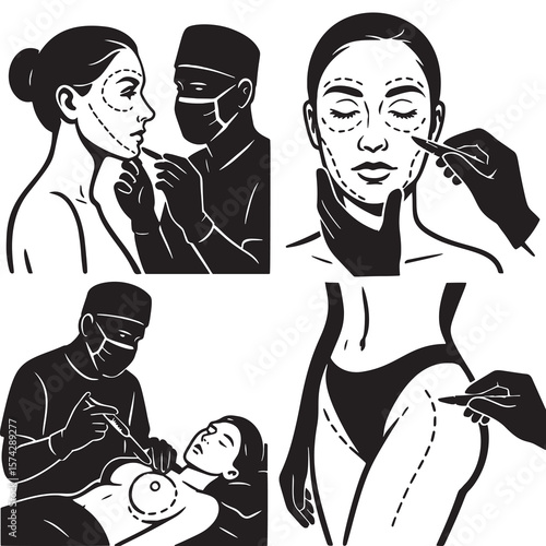 Black and white vector set showing plastic surgery procedures: facial markings, lip filler, breast augmentation, body contouring. Medical cosmetic operations. Isolated on white.