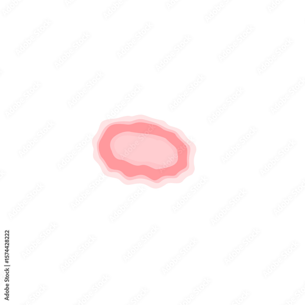 Fototapeta premium Dermatophytosis illustration