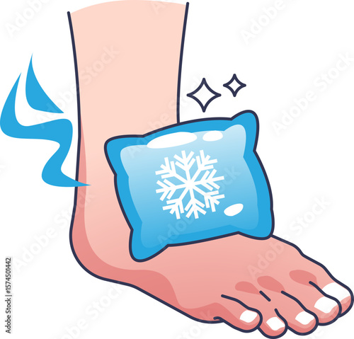 An illustration of an ice pack on a foot, representing cold therapy for an ankle injury. This medical intervention helps reduce swelling, inflammation, and pain from sprains or strains.