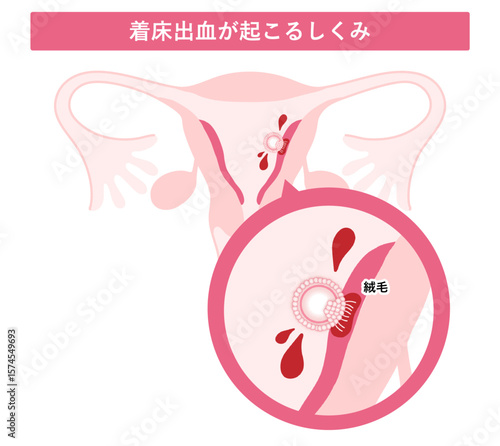 着床出血が起こるしくみ