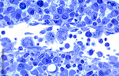 Lymph node. Medullary sinus. Macrophages