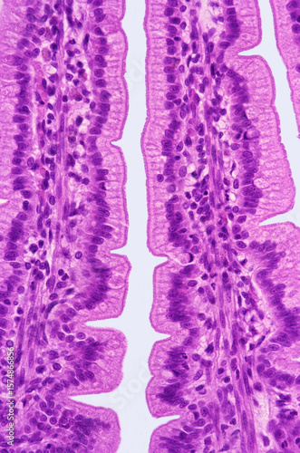 Intestinal epithelium