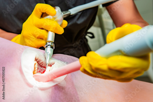 Dentistry. Professional dentist does hardware teeth cleaning with Air Flow for a patient. Ultrasonic teeth cleaning. Prevention and dental hygiene.