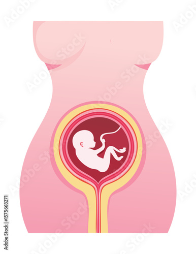 Fetus Positioned Inside Pregnant Woman's Abdomen
