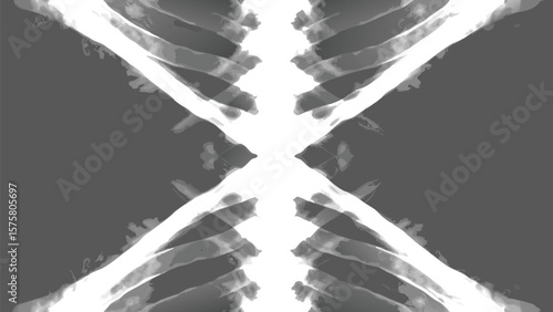 Radiographic image showing the rib cage and spine in a symmetrical arrangement on a gray background