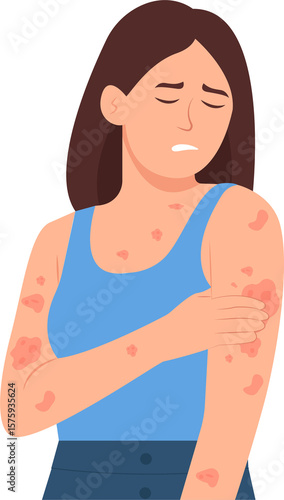 An unhappy woman scratching the skin on her hand. Various skin problems, such as allergies, psoriasis, itching, atopic dermatitis, eczema, dryness, redness.Vector Illustration