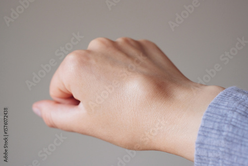 Female right back hand with ganglion cyst on the dorsum,  fluid-filled bump associated with a joint or tendon sheath, close-up view, selected focus.