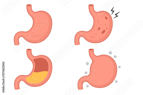 Human stomach collection. Internal organ, digestive system anatomy. Healthy, unhealthy, empty, full, bloated and pain stomach set. Nutrition, indigestion and gastritis.