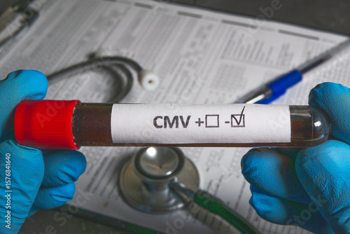 Doctor holding blood sample with cmv negative test result, medical background