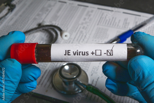 Doctor holding test tube with positive japanese encephalitis virus test result