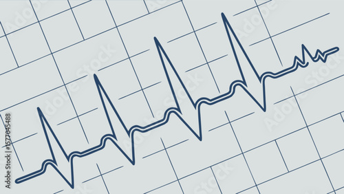 Ecg heartbeat rhythm medical pulse line graph cardiology health monitor vital signs waveform illustration vector