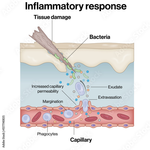 Inflammatory Response Mechanism – Tissue Injury, Bacterial Invasion, and Phagocyte Recruitment Vector Illustration