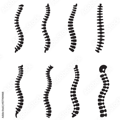 set vector various Spinal cord silhouettes , Spine Illustrations Showing Different Curvatures. Collection of Spinal Column Illustrations Anatomy Vertebrae