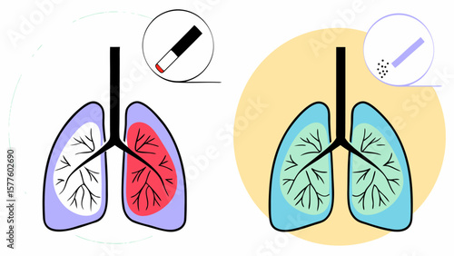 Comparison of Smoker’s Lungs and Healthy Lungs Anti-Smoking Vector Illustration