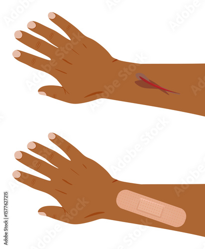 Hand injury patch. vector illustration	