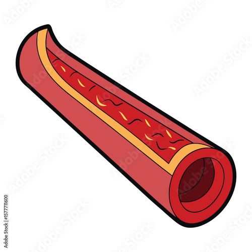 A normal artery is a blood vessel with smooth, flexible walls, allowing steady blood flow from the heart to tissues, delivering oxygen and nutrients efficiently.
