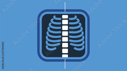 Illustration of a stylized x ray image showing ribs and spine on a blue background with x ray text