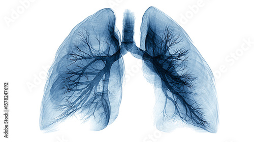 X-ray image of human lungs on clean tranparent background, isolated on tranparent background 