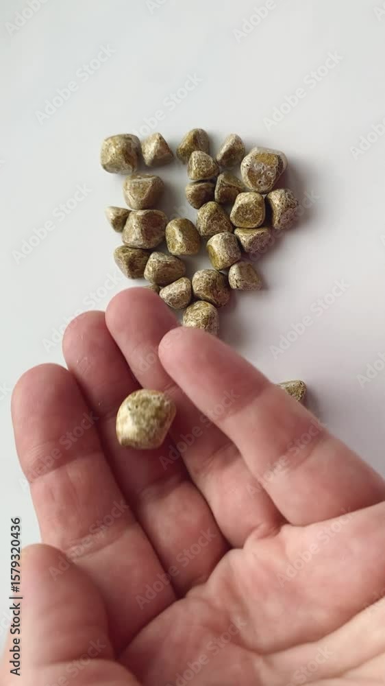 stones extracted from a human gallbladder stones extracted from a human gallbladder