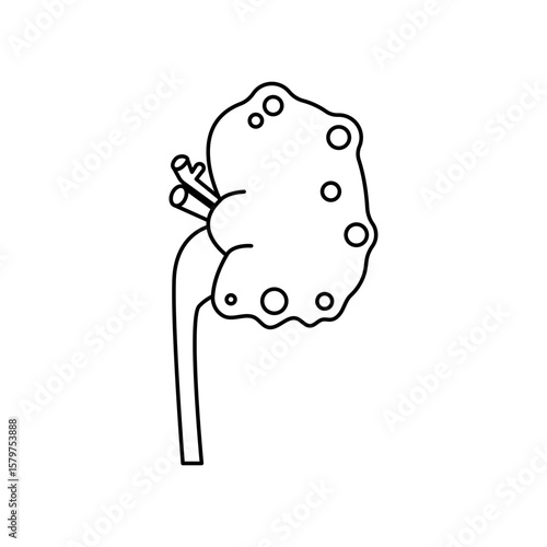 chronic kidney disease