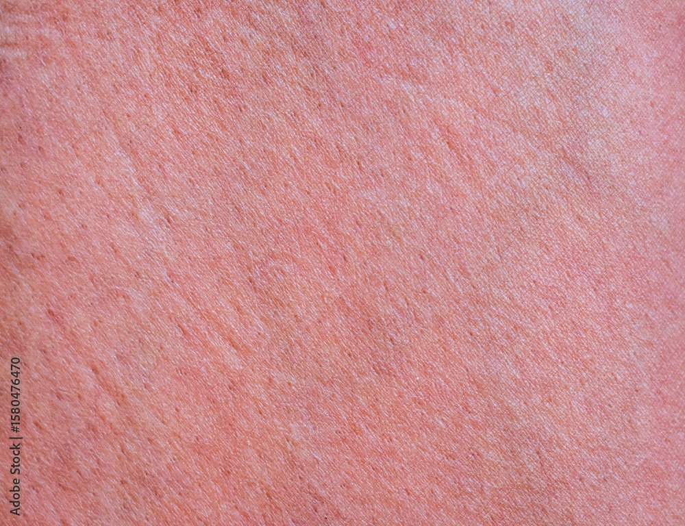 Fototapeta premium Human skin