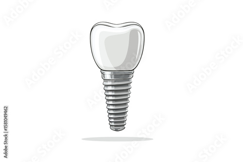 Tooth implant, isolated on white background