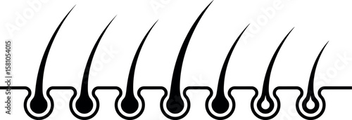 Hair follicle growth stages:  simple black vector illustration.