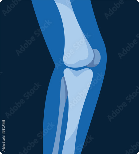 Human knee skeleton x-ray scan