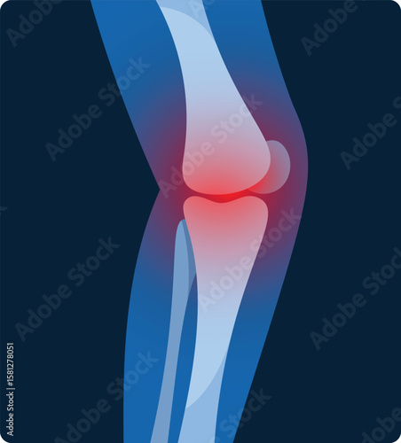 Knee joint inflammation x-ray vector illustration