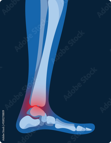 Ankle joint inflammation x-ray vector illustration