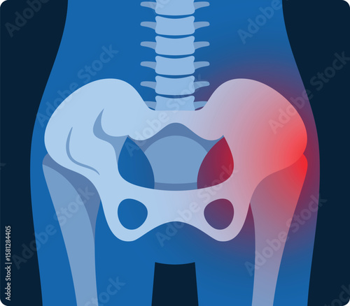 Femur joint inflammation x-ray vector illustration