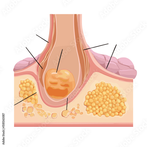 Vector illustration of sebaceous gland medical style on white background, for dermatology education