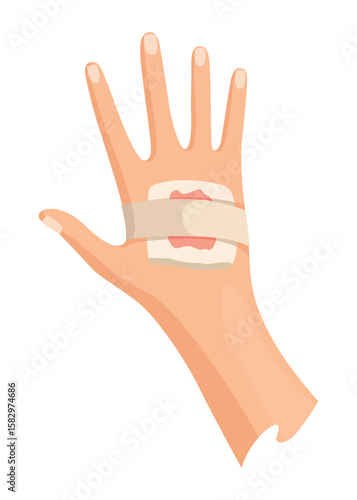 Hands injured skin and procedures of bandaging. First aid for wound. Medicine cure or treatment. First emergency help for human hand trauma