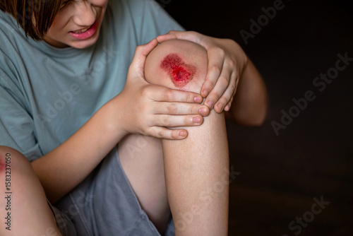 Fényképezés Child injured his knee when he fell