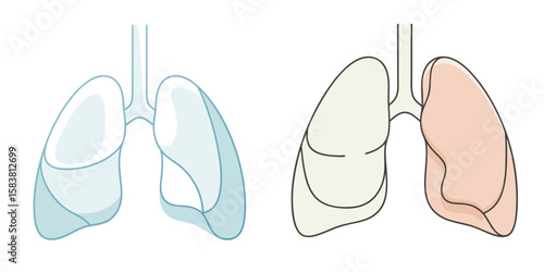 Human Lungs Anatomy Set in Blue and Pink for Respiratory Health Concepts