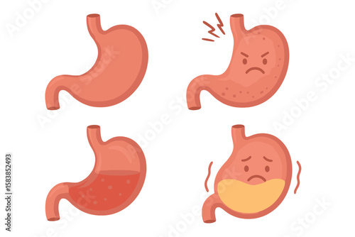 Human Stomach Anatomy Vector Set. Digestive System Organ, Stomach Care, Healthy and Unhealthy Stomach, Empty and Full Stomach, Nutrition, Stomach Pain, Medical Illustration, Gastrointestinal Health
