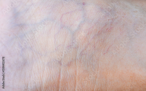 Capillaries on the human body.